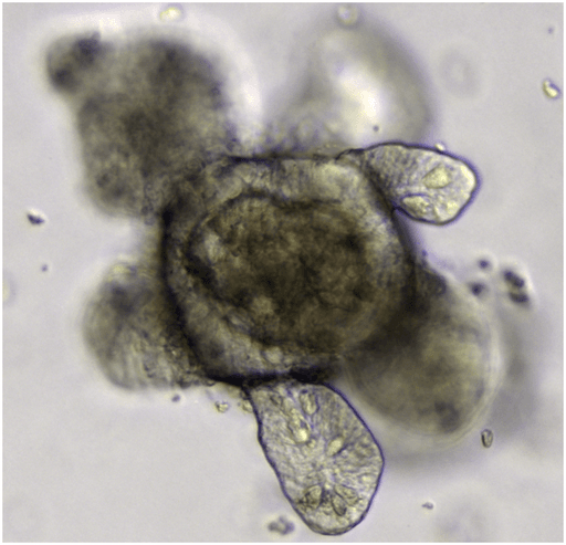 Building next generation growth factors for organoid-driven precision medicine: a protein engineering project…