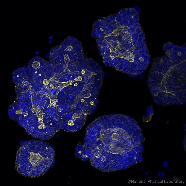 Cellesce organoids 2