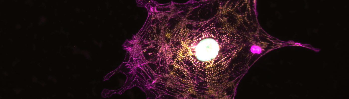 Cardiac organoid