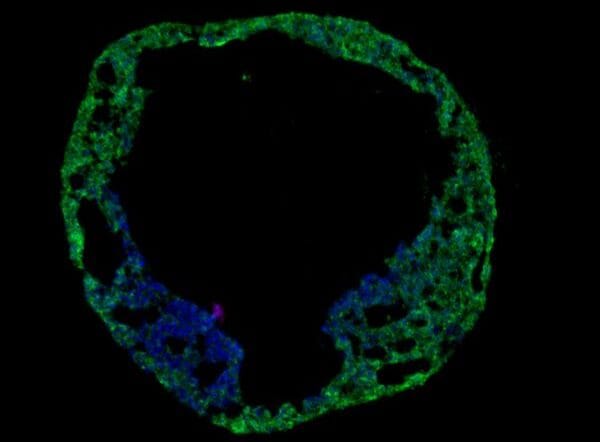 Cardiac organoids – the future of drug discovery? image