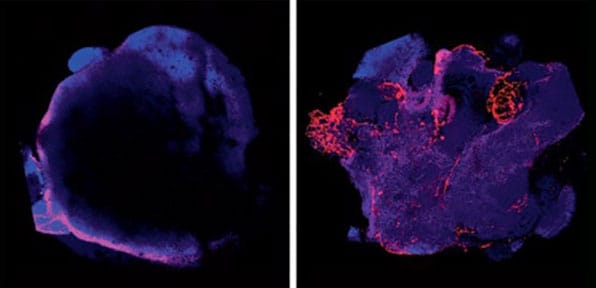 organoids-blog-h
