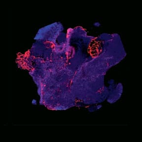 Nurturing Complexity: The role of vascularization in Organoid Advancements image