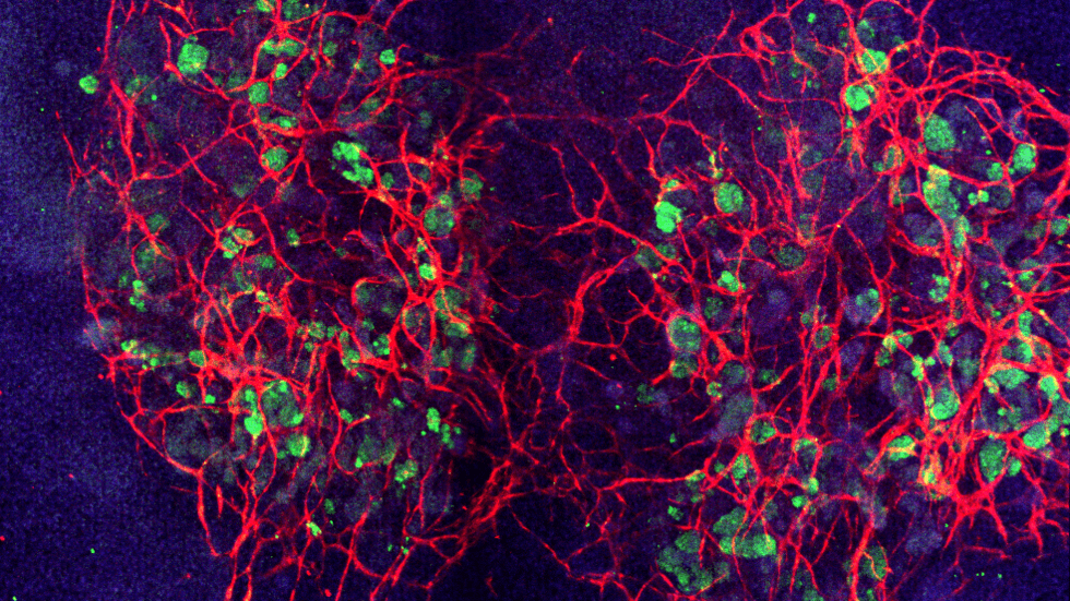 Qkine blog - Vascularized kidney organoids