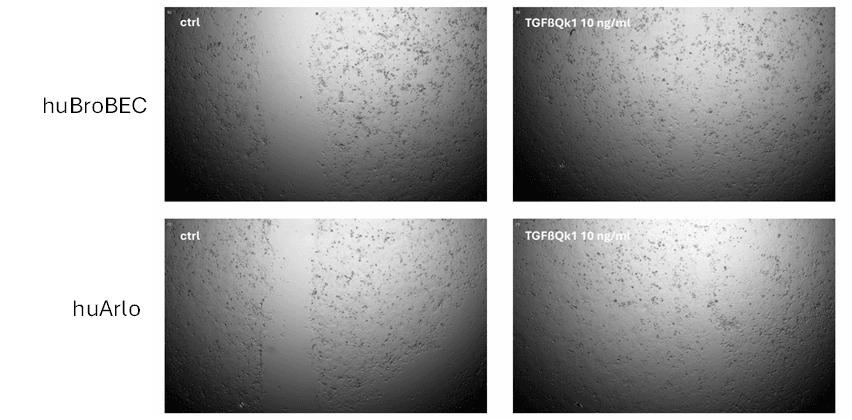 Wound healing assay Qkine TGF beta 1 stimulated would healing