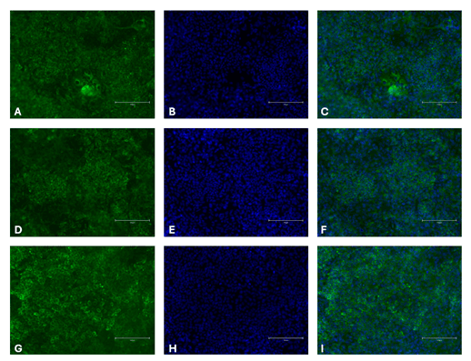 Immunocytochemistry of Hepatocellular markers in differentiated iPSCs