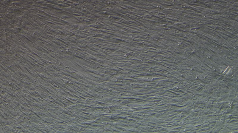 Sable bone marrow 100ng STAB 100X 800 2