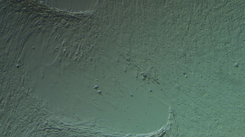 Sable bone marrow control 100X 800 2