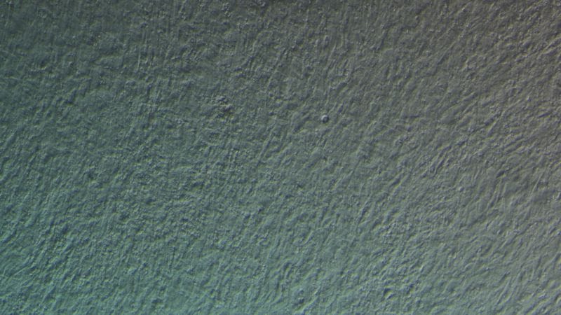 Sable muscle 10ng TGF B1 100X 800 2