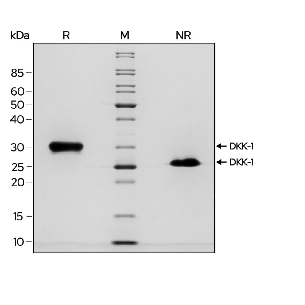DKK1 gel image