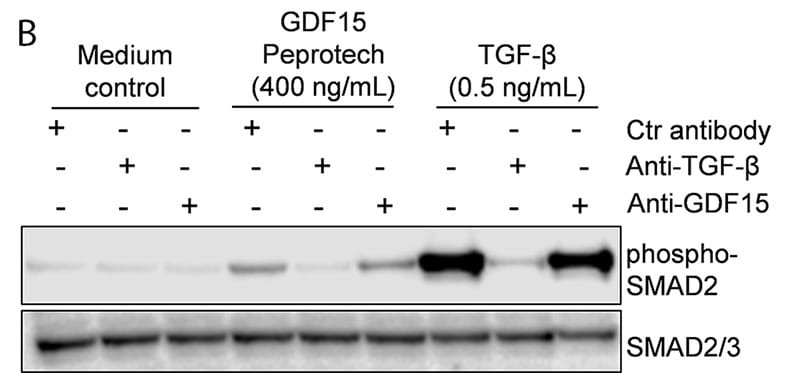 Figure 1B
