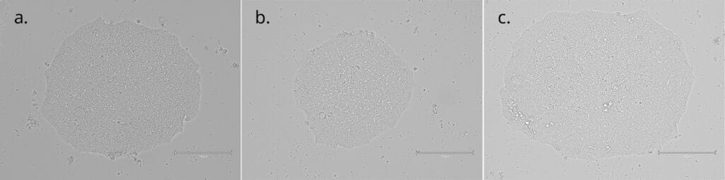 Figure 3 ABC combined 400px