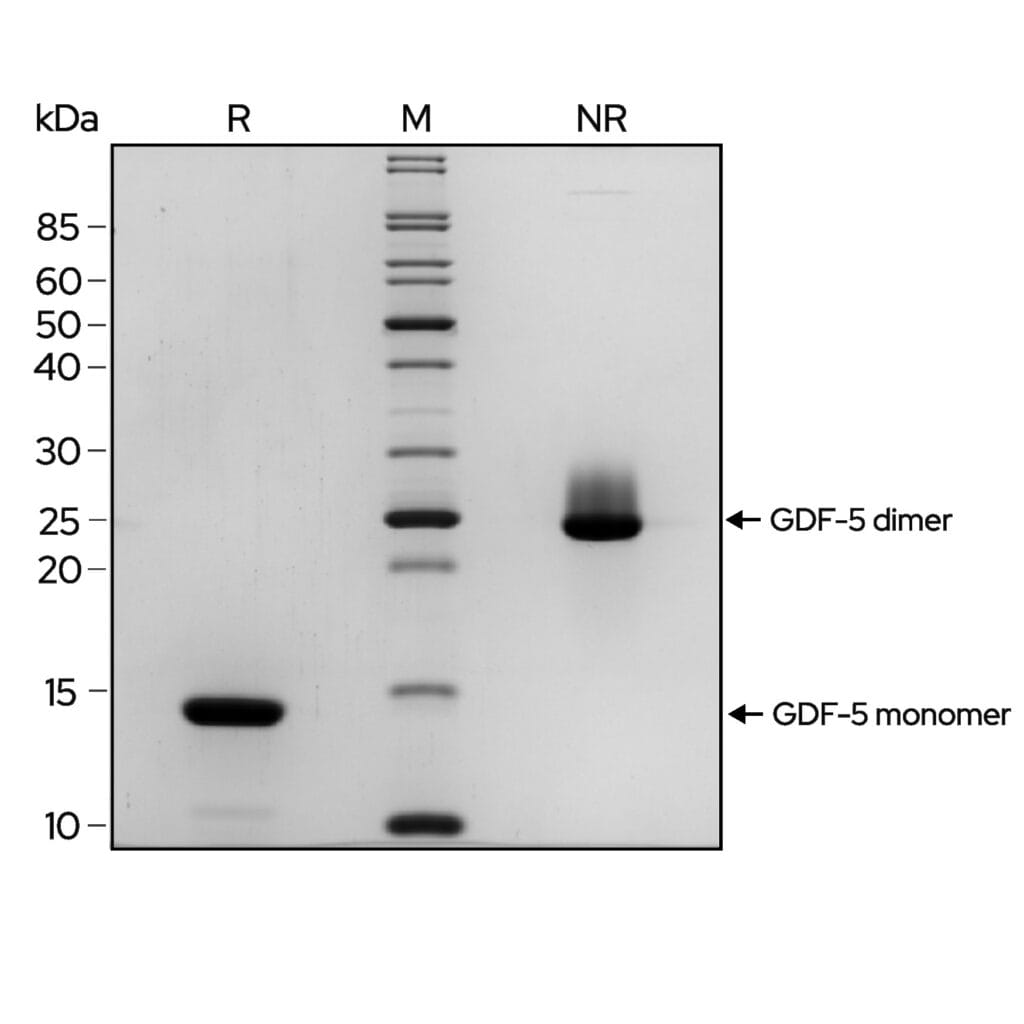 GDF 5 gel image