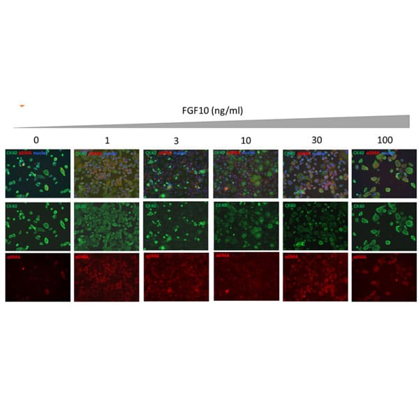 Human FGF 10 Qk003 bioactivityEMT immunofluorescence lot010