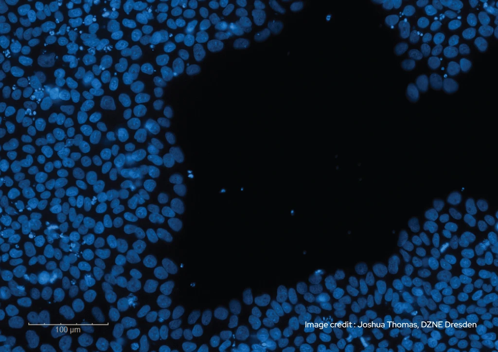 Joshua-Thomas-iPSCs-cultured-in-mTeSR™1-medium-Qkine-FGF2-G3-for-3-days-without-a-media-change-1.jpg-2023-1