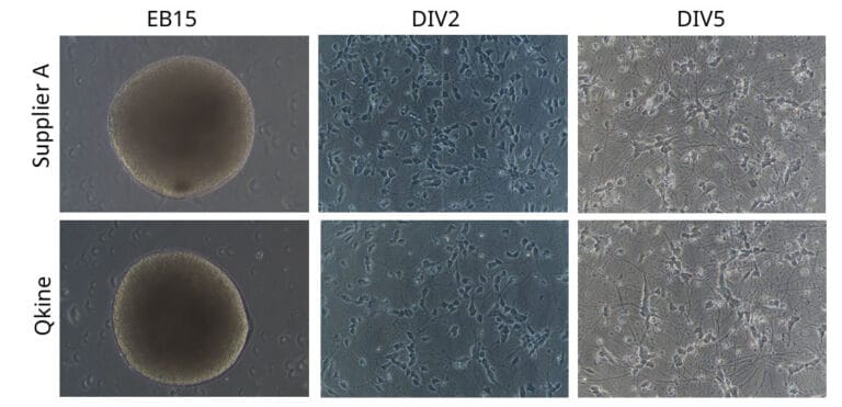 Neural differentiation with BDNF GDNF