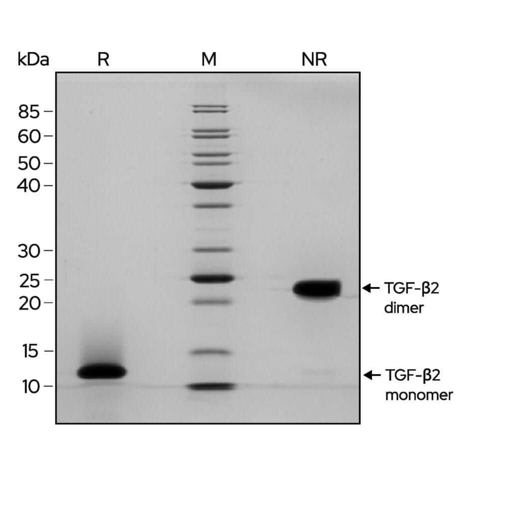 TGFb2 gel image 1