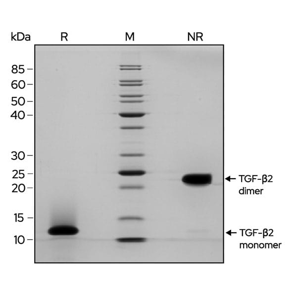 TGFb2-gel-image