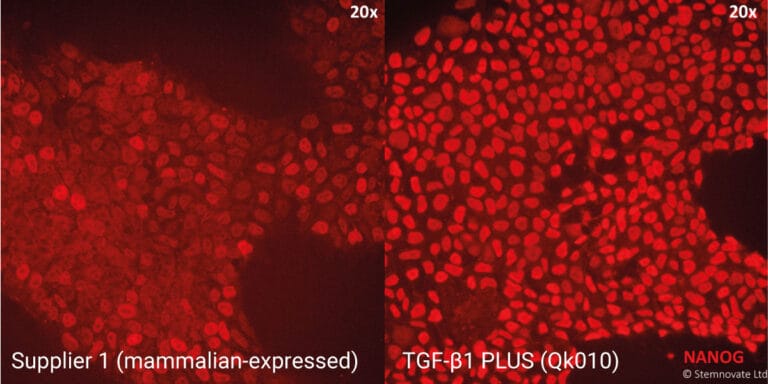Tgfb1 comparison 1200x600 high
