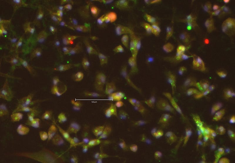 Raising the standard: Developing a high-quality IL-34 protein image